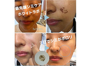 esthetic salon clearの新着情報写真